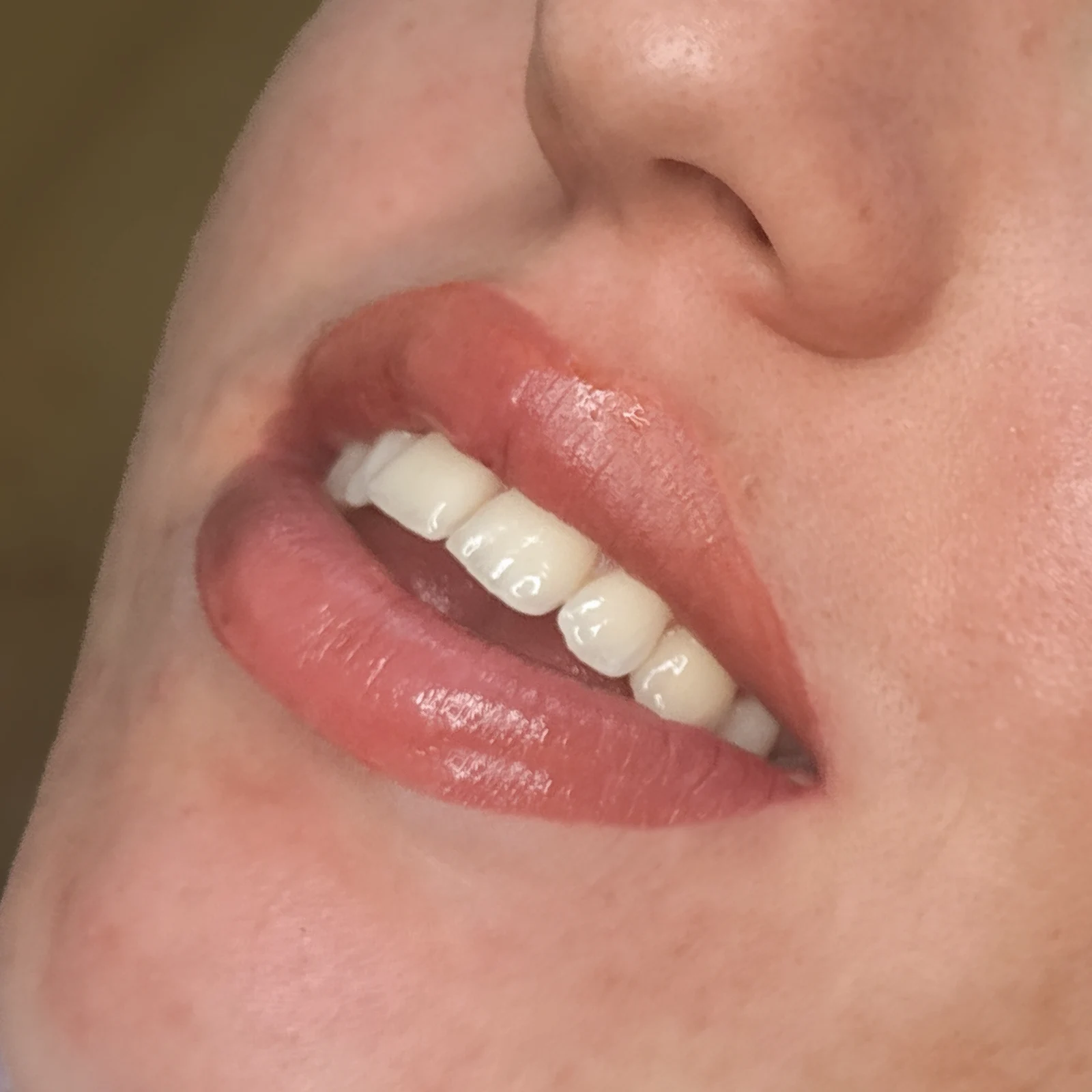 Pure Lips